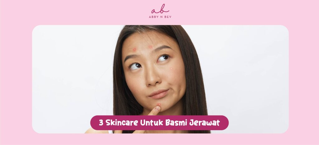 3 skincare untuk basmi jerawat - abby n bev toko kosmetik bandung